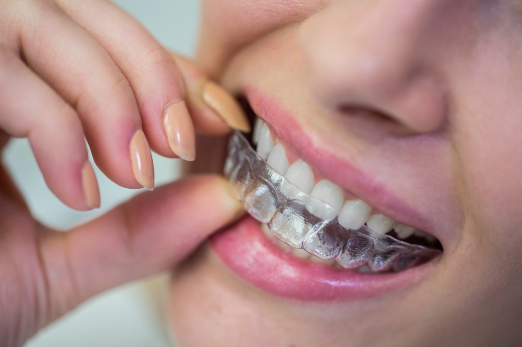 A woman wearing clear aligners and smiling confidently.