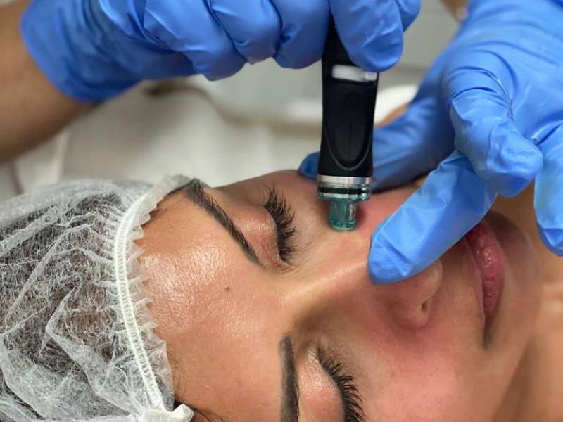 hydrafacial treatment