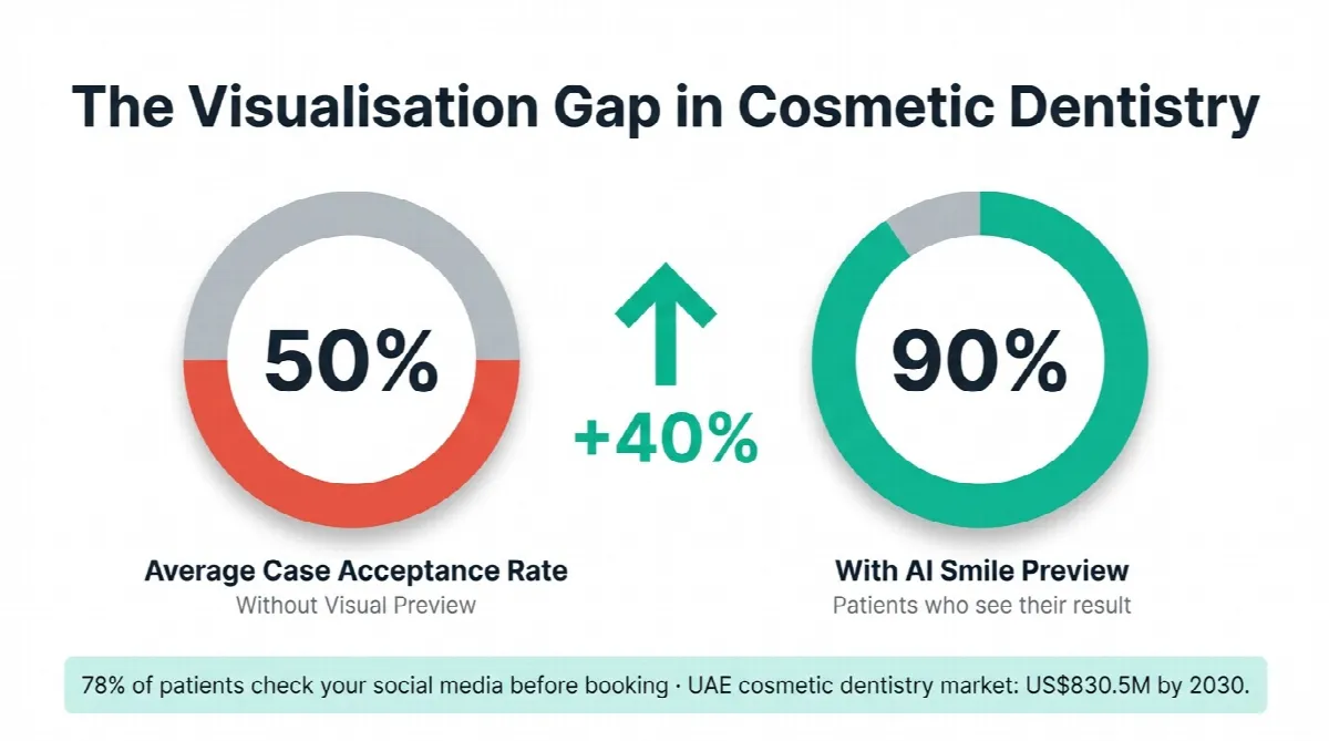Cosmetic dentistry case acceptance rate comparison showing 50% without visual preview versus 90% with AI smile preview and 40% improvement